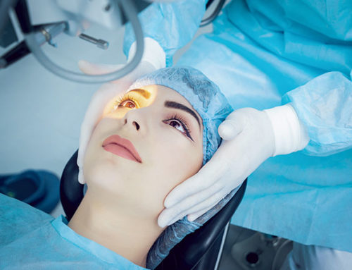 Comment se déroule une opération de la myopie ? Les étapes clés de la chirurgie réfractive