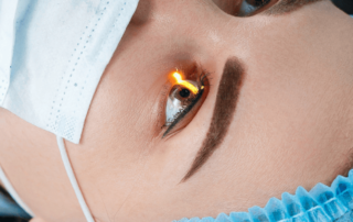 chirurgie réfractive en été ?