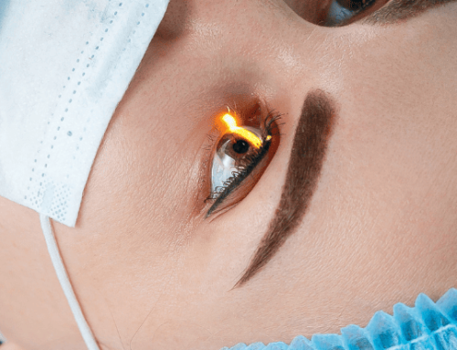 Est-ce que je peux me faire opérer de la chirurgie réfractive en été ?