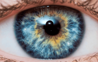 changer la couleur de ses yeux par chirurgie