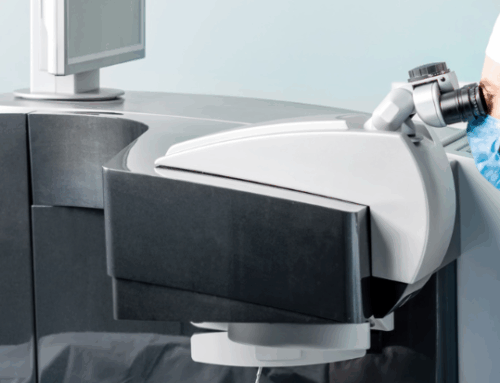 Tout savoir sur la chirurgie réfractive : vos peurs VS la réalité