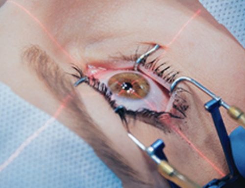 Chirurgie réfractive : quelles sont les différentes techniques pour corriger la vision ?