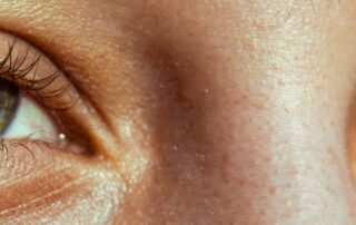 5 erreurs à éviter pour protéger ses yeux en été